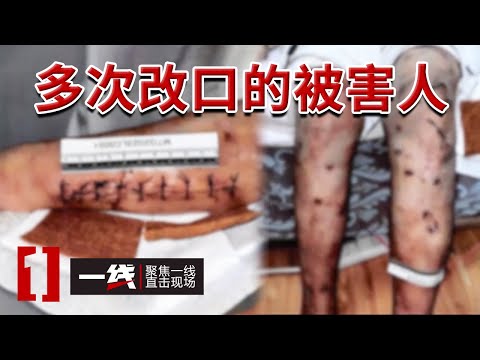 《一线》女子浑身伤痕报警称丈夫家暴 丈夫却说是妻子自残 真相究竟是什么？20241125