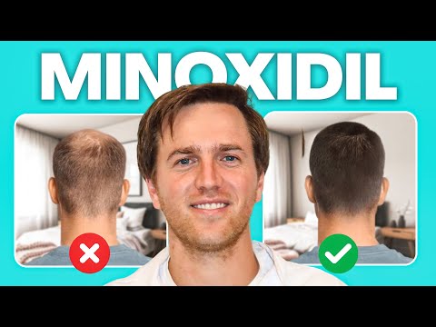 10 Things No One Tells You About Minoxidil (But You should Know)