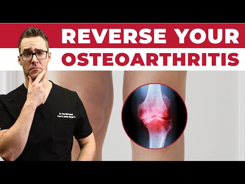 How to Regrow Cartilage & Reverse OsteoArthritis? [Can We Do It?]