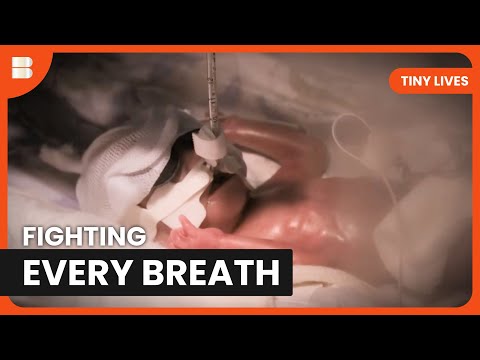 23 Week Premature Baby Inis Fights for Life at Wishaw