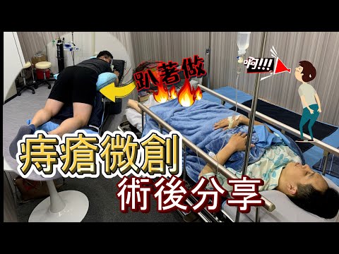 不再當有痔青年?!傳統好還是微創讚?我的微創手術大公開!! #痔瘡 #微創手術 #傳統手術