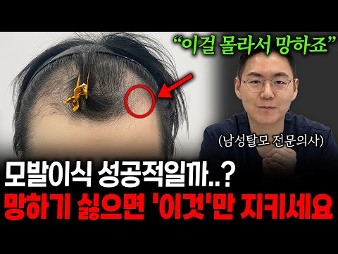 모발이식 후 부작용을 최소화 하는 방법 및 주의사항