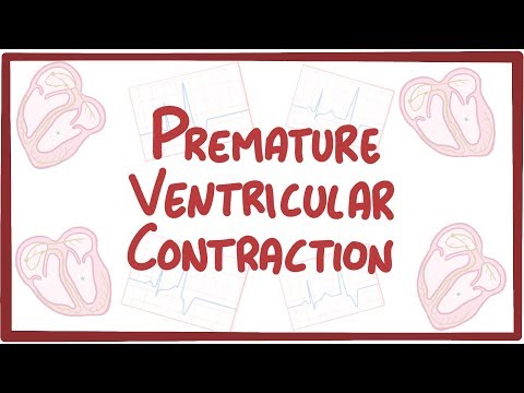 Premature Ventricular Contraction - causes, symptoms, diagnosis, treatment, pathology