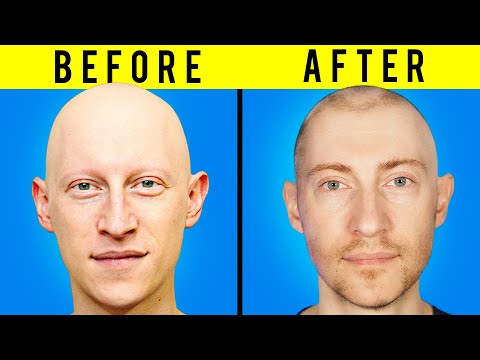 How I Got My Hair Back...