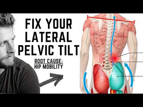 Struggling With Lateral Pelvic Tilt? Do THIS for Balance
