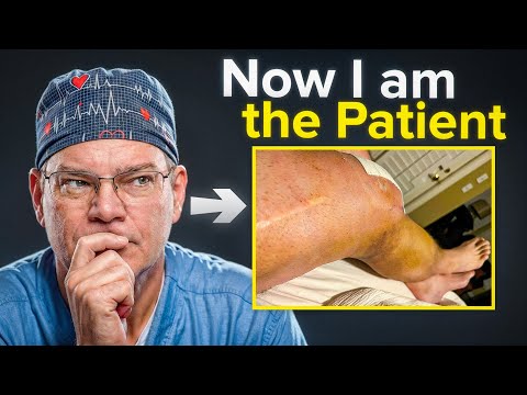 I’m a Knee Surgeon — 5 Things I Learned From My Own Knee Replacement