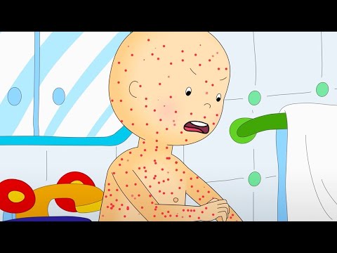 Chicken Pox | Caillou | WildBrain Kids