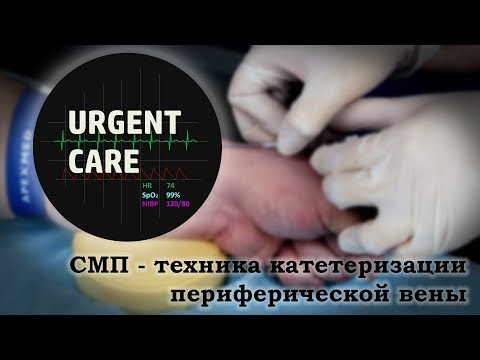 SMP - Peripheral vein catheterization technique