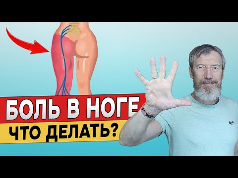 5 Упражнений от Защемления Седалищного Нерва!