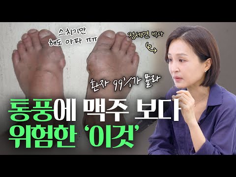 통풍 환자 10명 중 9명, 이걸 매일 먹습니다 | 정세연의 라이프연구소