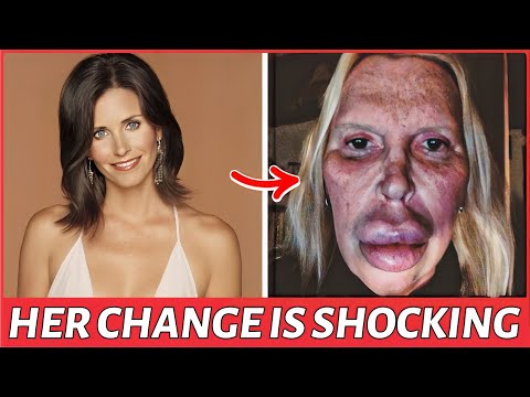 TOP 22 Hollywood Celebrities Who RUINED Their Careers With PLASTIC SURGERY | Vintage Hollywood