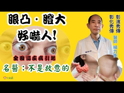 「頭歪一邊」 頸載1.5公斤巨瘤！甲狀腺權威揭離奇病例