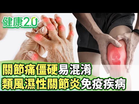 關節痛僵硬易混淆 類風濕性關節炎自體免疫疾病【健康2.0分段】@tvbshealth20  EP3139-1 20251213 #陳欣湄#韋汝#黃光永#柳朋馳#鄒瑋倫#胡逸惟#彥寬