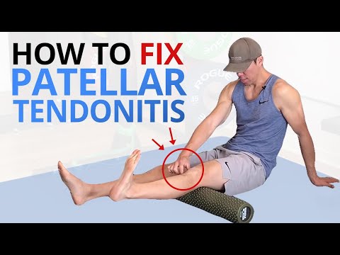 Why Common Patellar Tendonitis Rehab FAILS and 5 exercises that WORK!