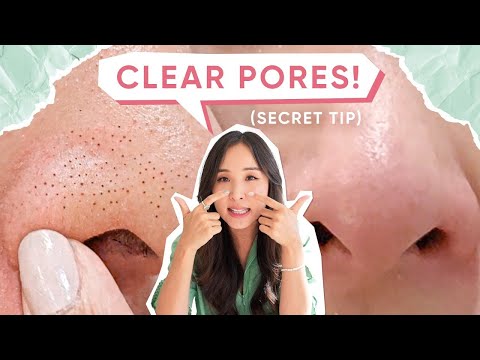 My *no fail* Routine for BLACKHEADS, LARGE PORES &amp; ACNE!👌