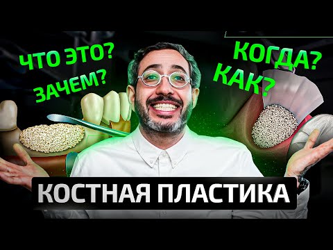 Все о костной пластике простыми словами за 12 минут 36 секунд