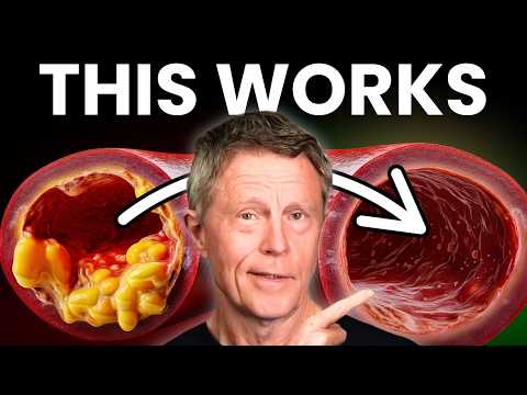 #1 Best Meal to Unclog Your Arteries