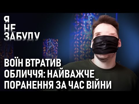Очі, ніс, щелепа – поранення, яке ШОКУВАЛО медиків: історія бійця Владислава