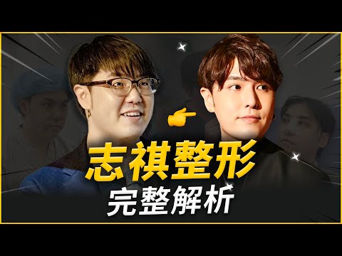 醫師親自說明！志祺七七整哪裡？手術為何這樣設計？看待輿論真實想法？超深度訪談｜依心唯美 謝東穎醫師 feat.志祺七七 X 圖文不符 @shasha77