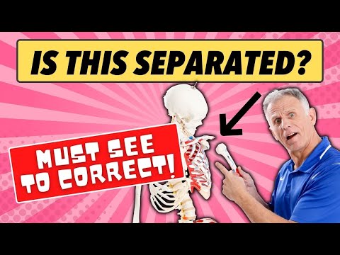 Is Your Shoulder Separated? All You Need To Know!