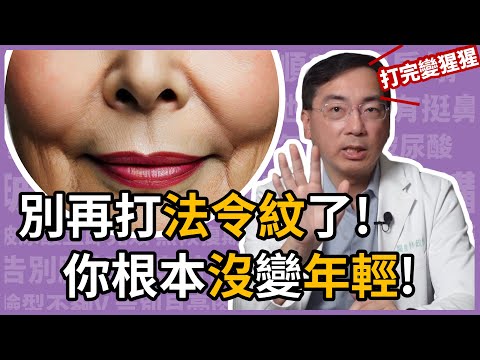 三大法令紋微整形的誤區，及三大關鍵治療心法！