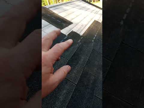 20 year Shingles. #shorts