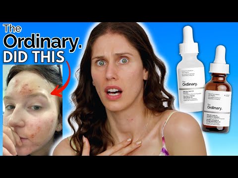 WHAT HAPPENED TO THE ORDINARY'S SALICYLIC ACID?! VS THE NEW SALICYLIC ACID ANHYDROUS SOLUTION