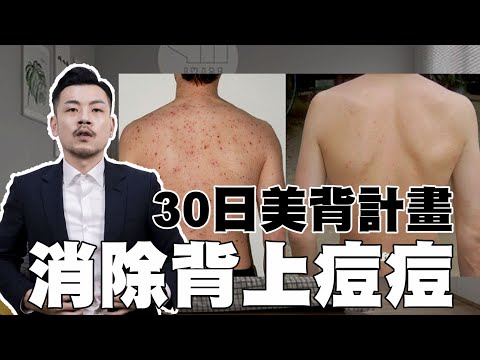 背上痘痘徹底消除 !! 30天最強美背計畫，夏天來臨前必學~~【77老大】
