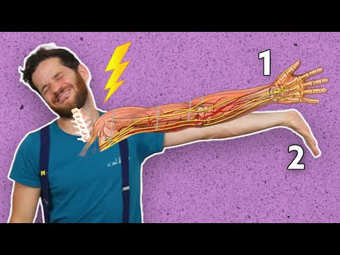 Neurodynamics will change your life! (Tendinitis, cervicobrachial neuralgia, sciatica)