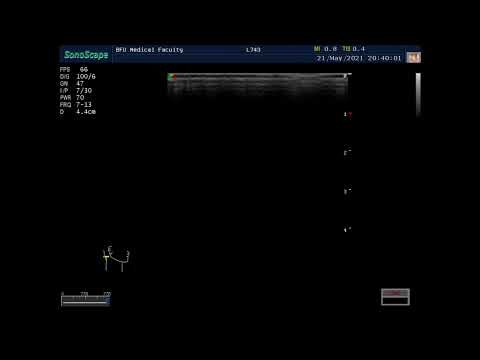 Отработка практических навыков по УЗИ лимфатических узлов.