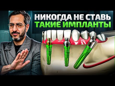Все виды имплантов в 1 видео! Какой имплант выбрать в 2025 году?