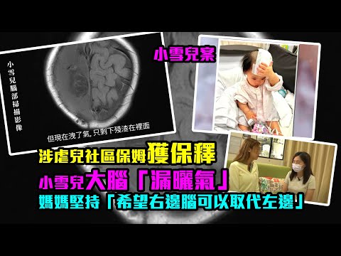 小雪兒案｜涉虐兒社區保姆獲保釋　小雪兒大腦「漏曬氣」媽媽堅持「希望右邊腦可以取代左邊」|TVB|東張西望