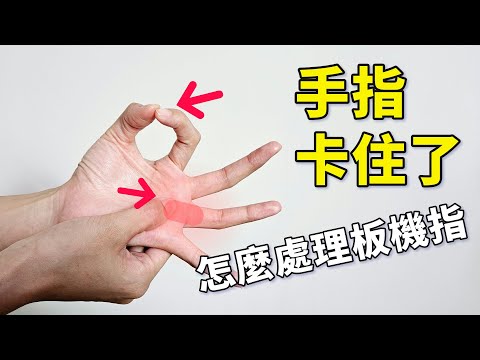手指僵硬？找回手指靈活度，告別扳機指！ ｜#板機指 #啾c物理治療師
