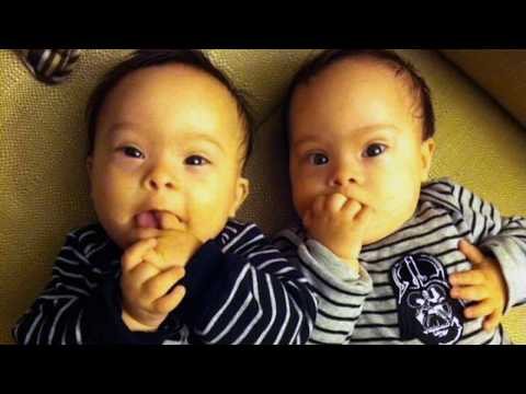 Twins with Down syndrome “They give you unfiltered love”