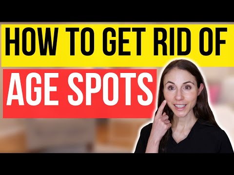 How To Get Rid Of Age Spots | Dermatologist Tips