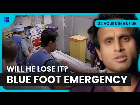Motorcyclist Blue Foot After 40mph Crash Emergency | 24 Hours in A&E