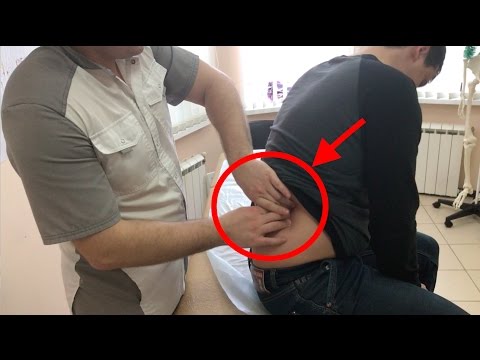 Смещение позвонка в пояснице. Лечение боли в пояснице за 10 минут. How To fix Lower Back Pain