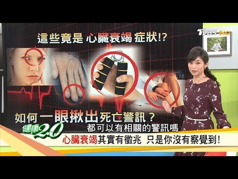 累喘腫竟是「心臟衰竭」症狀？心臟要有力，趕快練握力！健康2.0 (完整版)