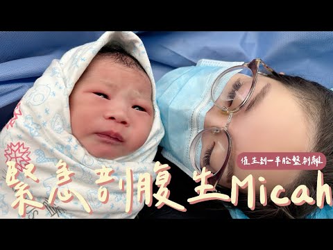 催生到一半胎兒心跳驟降、胎盤剝離,最後吃全餐剖腹產的生產全紀錄 | 蔻蔻theCoco