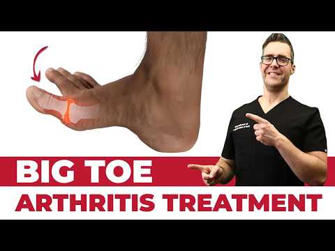 Stiff Big Toe Joint Pain(Hallux Rigidus) TREATMENT [Exercises, Taping]