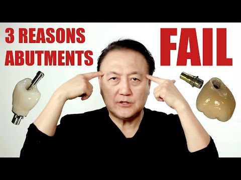 Avoid These 3 Common Implant Abutment Mistakes