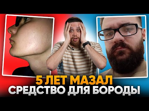 5 ЛЕТ со средством для роста бороды / САМЫЙ ИНФОРМАТИВНЫЙ ВЫПУСК!