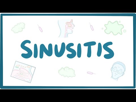 Sinusitis - causes, symptoms, diagnosis, treatment, pathology