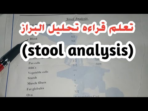 تعلم قراءه تحليل البراز بكل سهوله (stool analysis)