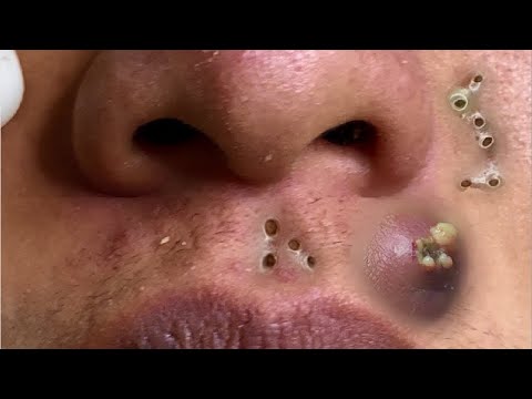 𝑺𝒐𝒐𝒕𝒉𝒊𝒏𝒈 𝑭𝒂𝒄𝒊𝒂𝒍 𝑻𝒓𝒆𝒂𝒕𝒎𝒆𝒏𝒕 𝒇𝒐𝒓 𝑺𝒕𝒓𝒆𝒔𝒔 𝑹𝒆𝒍𝒊𝒆𝒇 | 𝑫𝒆𝒆𝒑 𝑪𝒍𝒆𝒂𝒏𝒊𝒏𝒈 & 𝑪𝒂𝒍𝒎𝒊𝒏𝒈 𝑴𝒂𝒔𝒔𝒂𝒈𝒆 𝒂𝒕 𝑳𝒖𝒙𝒖𝒓𝒚 𝑺𝒑𝒂 #𝟗𝟎𝟎𝟑𝟖𝟳