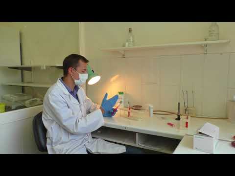 Методы идентификации микроорганизмов. Трехсахарный агар. Оксидазный тест.