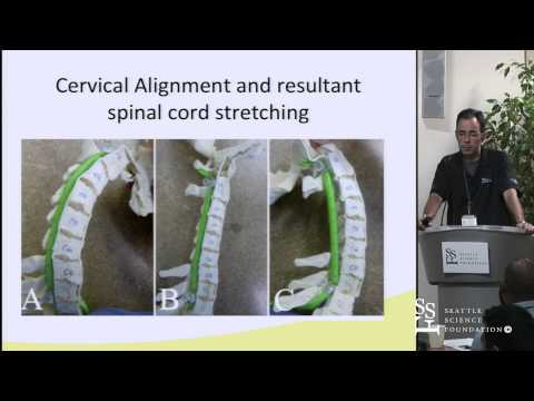Management of Cervical Stenosis: Anterior vs Posterior Approaches by Charles Sansur, M.D.