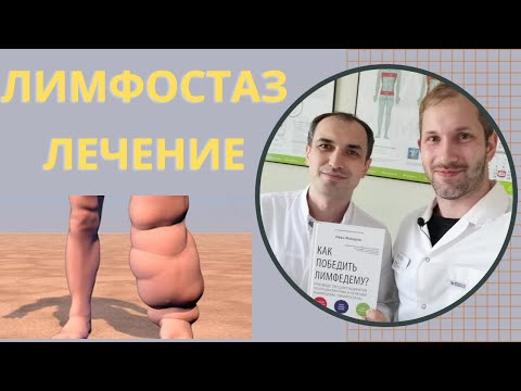 Лимфостаз лечение. Флеболог Москва.