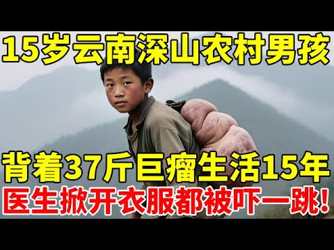 15岁云南深山农村男孩,背着37斤巨瘤生活15年,医生掀开衣服都被吓一跳!【奇闻故事】