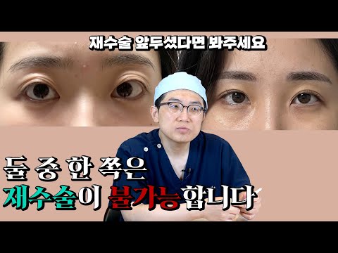 두 눈 중 하나는 재수술이 불가능합니다.(온라인 성형 상담)